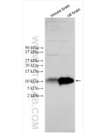 S100B Polyclonal antibody Proteintech  15146-1-AP