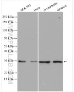 Geminin Polyclonal antibody Proteintech  10802-1-AP