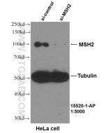MSH2 Polyclonal antibody Proteintech  15520-1-AP