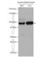 ATP1A1/2/3/4 Polyclonal antibody Proteintech  16836-1-AP