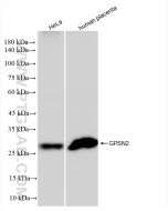 GPSN2 Recombinant monoclonal antibody Proteintech  83592-4-RR