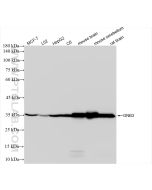 GNB3 Recombinant monoclonal antibody Proteintech  83452-4-RR