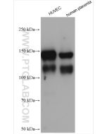 VE-cadherin/CD144 Polyclonal antibody Proteintech  27956-1-AP