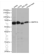 BMPR1A Recombinant monoclonal antibody Proteintech  82928-1-RR