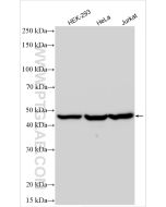 Perilipin 3/TIP47 Polyclonal antibody Proteintech  10694-1-AP