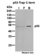 ChromoTek p53 C-term-Trap Agarose, Kit for Immunoprecipitation pta2k proteintech