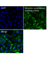 ChromoTek Vimentin RecAb, VHH-mouse IgG1 Fc fusion vfms proteintech