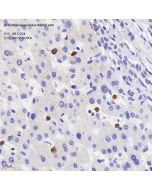 Anti-Myeloperoxidase Rabbit pAb servicebio GB11224-100