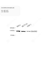 Anti-DIAPH2/DIA Rabbit pAb servicebio GB111871-100