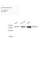 Anti-TNF12 Rabbit pAb servicebio GB112437-50