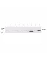 Anti-Cyclin E1 Rabbit pAb servicebio GB13305-50