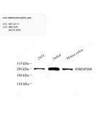Anti-SNRNP200 Rabbit pAb servicebio GB112111-100
