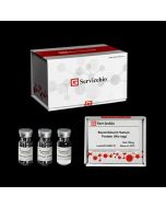 Recombinant Human PCT Protein servicebio GB311062-H-10μg