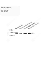 Anti-AK5 Rabbit pAb servicebio GB111732-100
