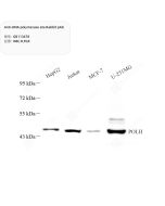 Anti-DNA polymerase eta Rabbit pAb servicebio GB113678-100