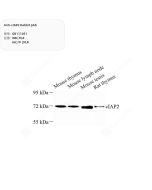 Anti-cIAP2 Rabbit pAb servicebio GB111051-100