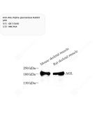 Anti-AGL/Alpha-glucosidase Rabbit pAb servicebio GB115450-100