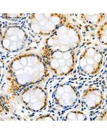 Anti-ATF-4 Rabbit pAb servicebio GB111137-100