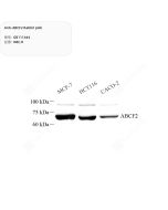 Anti-ABCF2 Rabbit pAb servicebio GB111444-100
