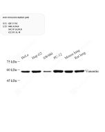 Anti-Vimentin Rabbit pAb servicebio GB11192-100