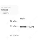 Anti-TIMP2 Rabbit pAb servicebio GB112670-100