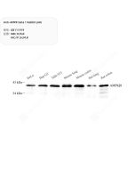 Anti-AMPK beta 1 Rabbit pAb servicebio GB111919-100