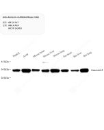 Anti-Annexin-4/ANXA4 Mouse mAb servicebio GB121147-50