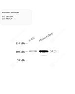 Anti-DACH1 Rabbit pAb servicebio GB114605-100