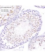 Anti-ACRBP Rabbit pAb servicebio GB112748-50