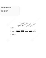 Anti-ATF-4 Rabbit pAb servicebio GB11813-100