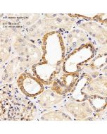 Anti-UQCRC1 Rabbit pAb servicebio GB113617-100