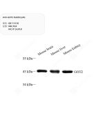 Anti-GOT2 Rabbit pAb servicebio GB113130-50