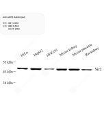 Anti-SIRT2 Rabbit pAb servicebio GB112450-100