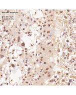 Anti-SUN1 Rabbit pAb servicebio GB115219-100