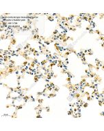 Anti-Corticotropin Releasing Factor Receptor 2 Rabbit pAb servicebio GB11708-100