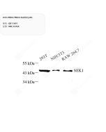 Anti-MEK4/MKK4 Rabbit pAb servicebio GB11691-100