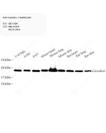 Anti-Caveolin-1 Rabbit pAb servicebio GB11409-100