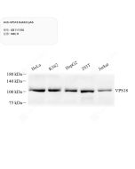 Anti-VPS18 Rabbit pAb servicebio GB111550-100