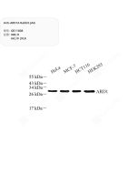 Anti-ARD1A Rabbit pAb servicebio GB11808-100