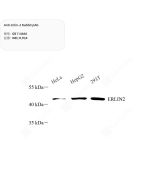 Anti-Erlin-2 Rabbit pAb servicebio GB114666-50