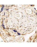Anti-ARID3A Rabbit pAb servicebio GB114705-100