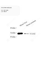 Anti-STAM2 Rabbit pAb servicebio GB113020-100