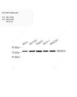 Anti-MID1 Rabbit pAb servicebio GB112569-50