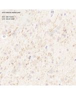 Anti-HAPLN2 Rabbit pAb servicebio GB115254-100