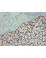 Anti-TGF beta Receptor I Mouse mAb servicebio GB14152-50