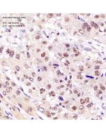 Anti-HES3 Mouse mAb servicebio GB121219-100
