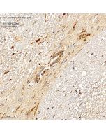 Anti-Contactin 6 Rabbit pAb servicebio GB112086-100