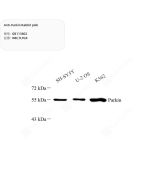 Anti-Parkin Rabbit pAb servicebio GB113802-100