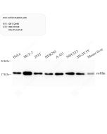 Anti-Cofilin Rabbit pAb servicebio GB112496-50