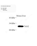 Anti-Nebulette Rabbit pAb servicebio GB113046-50